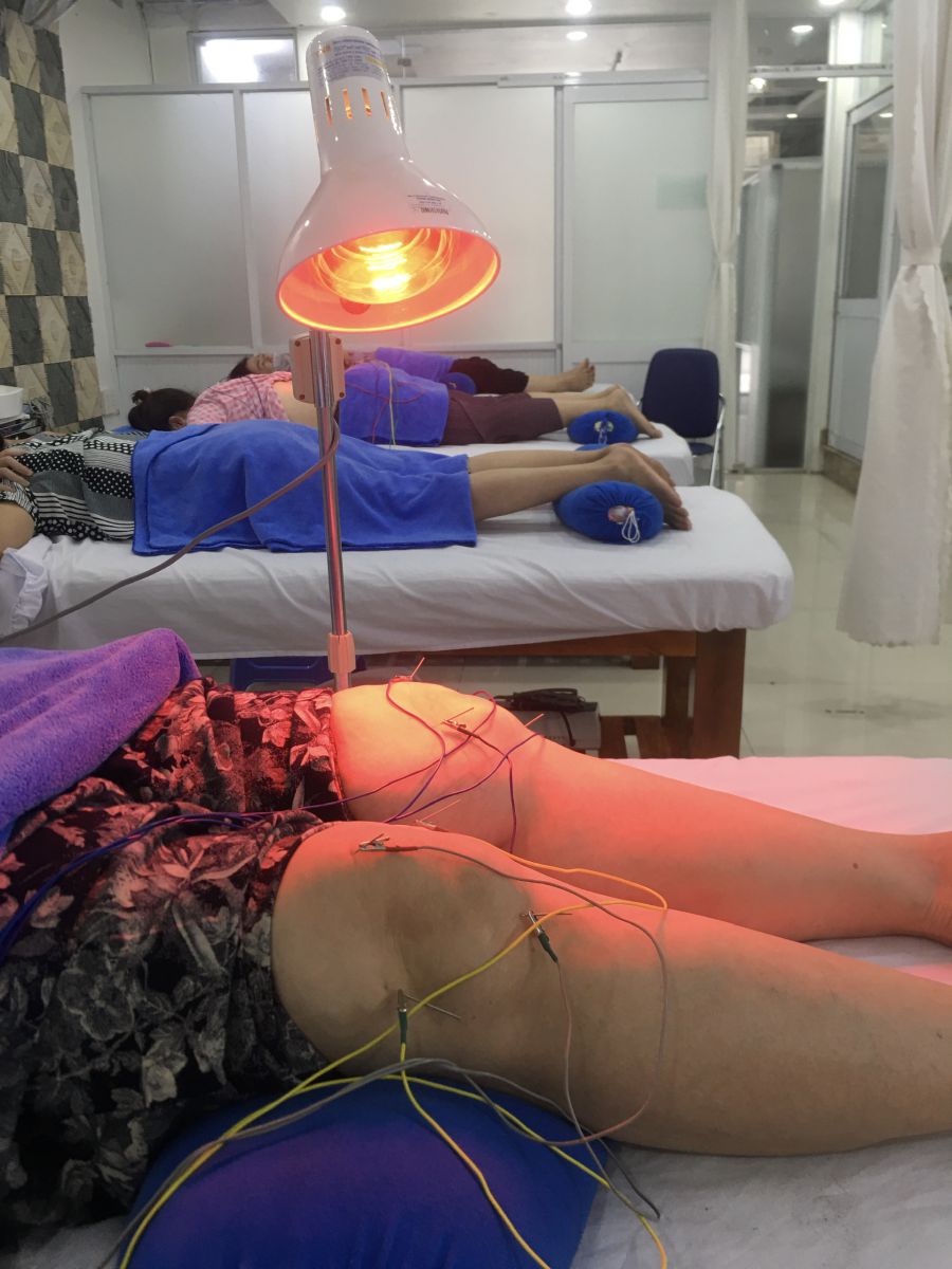 Châm cứu điều trị đau nhức cơ xương khớp